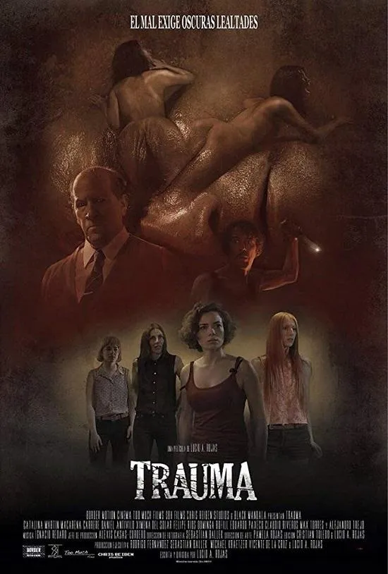 Травма